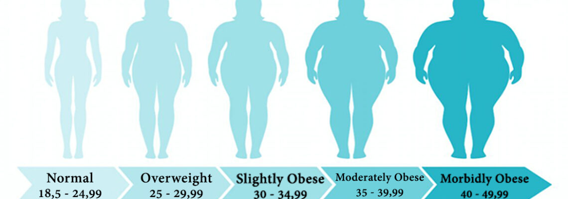 Bariatric Surgery (Obesity Surgery)