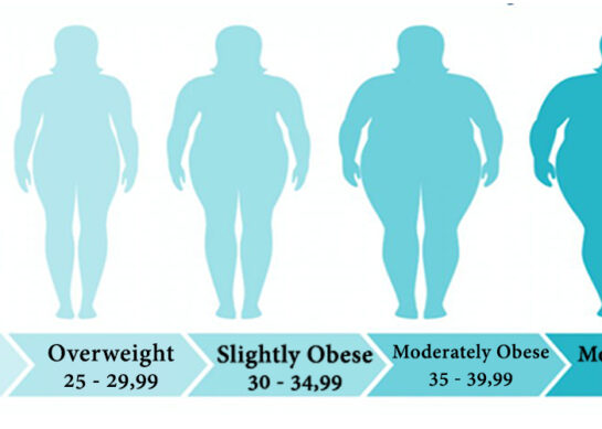 Bariatric Surgery (Obesity Surgery)