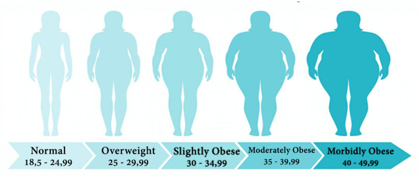 Bariatric Surgery (Obesity Surgery)